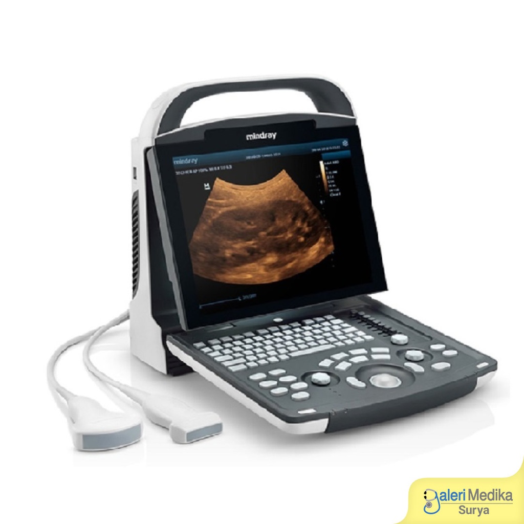 Alat USG 2D Mindray DP-10 Digital Doppler Ultrasound System LED Screen 12.1"