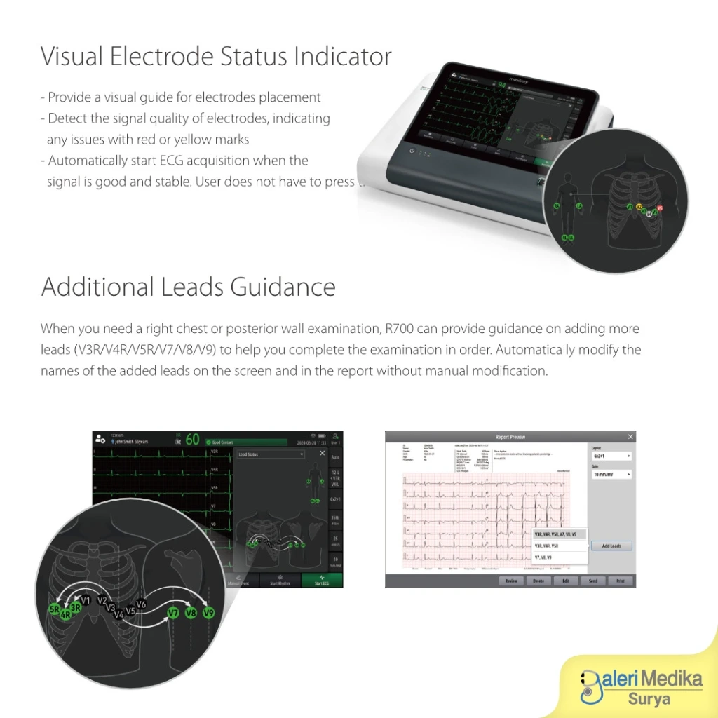 mindray-beneheart-r700-ecg-monitor-2.webp