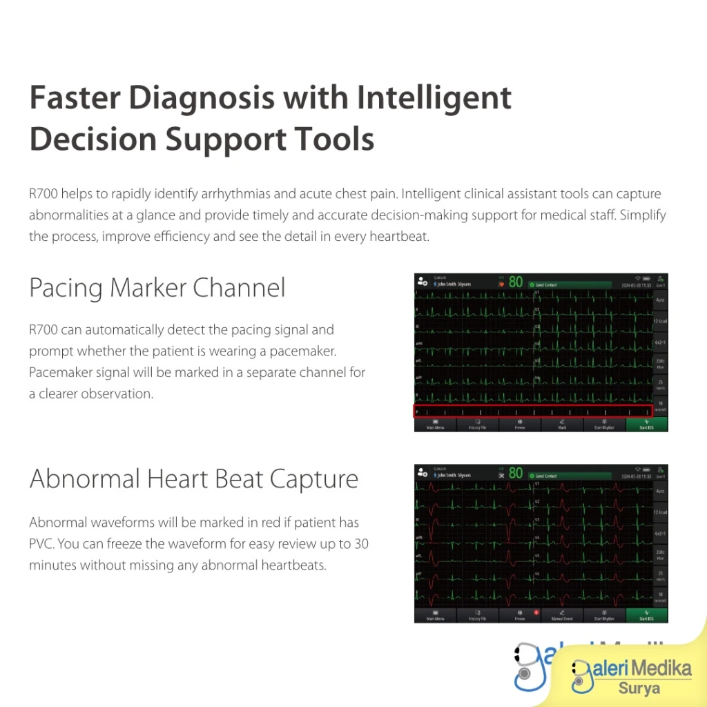 mindray-beneheart-r700-ecg-monitor-3.webp