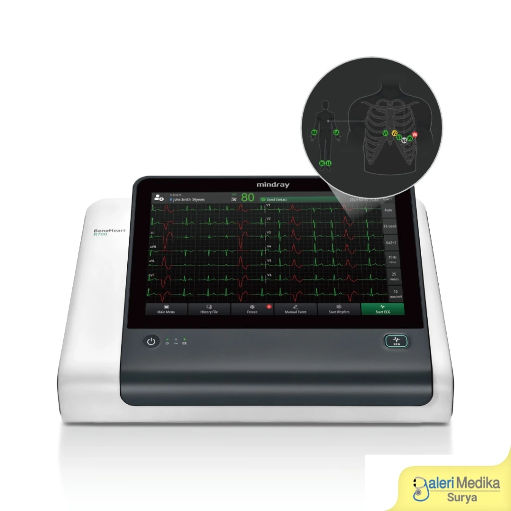 Mindray BeneHeart R700 Electrocardiograph ECG Machine 12-Lead